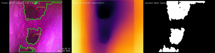 Depth estimation and junction detection from endoscope feed